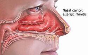 V&#236; sao rối loạn khứu gi&#225;c?